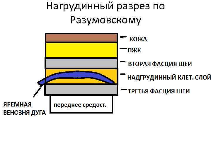 Нагрудинный разрез по Разумовскому 