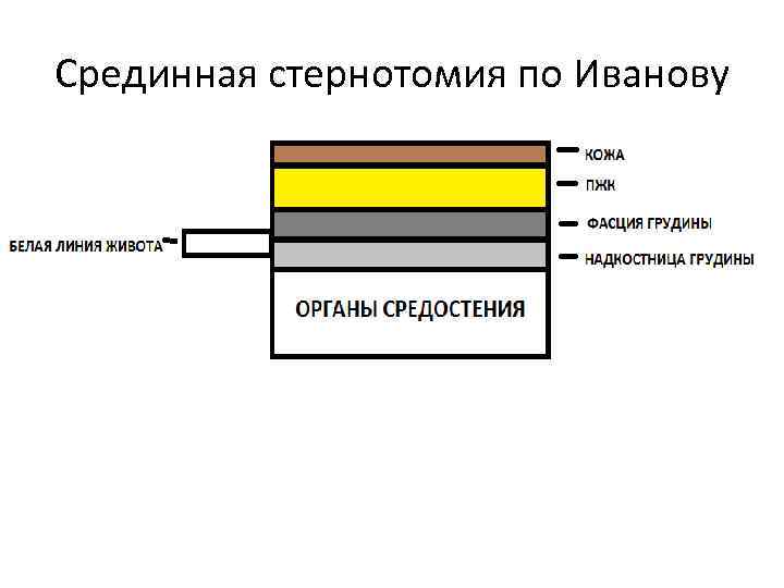 Срединная стернотомия по Иванову 