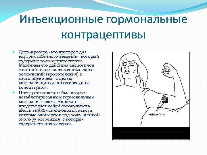 Инъекционные гормональные контрацептивы Депо-провера -это препарат для внутримышечного введения, который содержит только прогестерон. Механизм