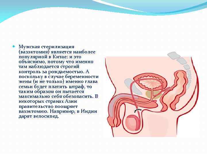 Мужская стерилизация (вазэктомия) является наиболее популярной в Китае: и это объяснимо, потому что