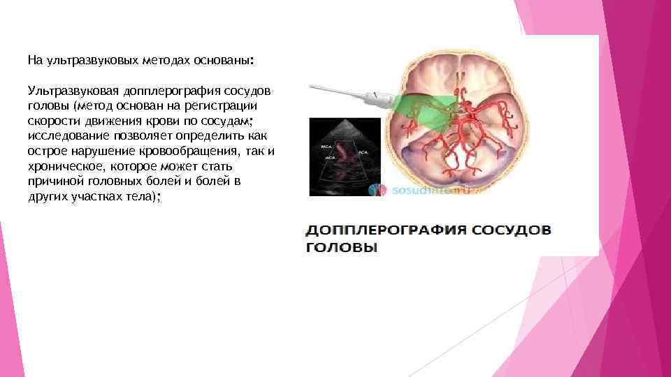 На ультразвуковых методах основаны: Ультразвуковая допплерография сосудов головы (метод основан на регистрации скорости движения