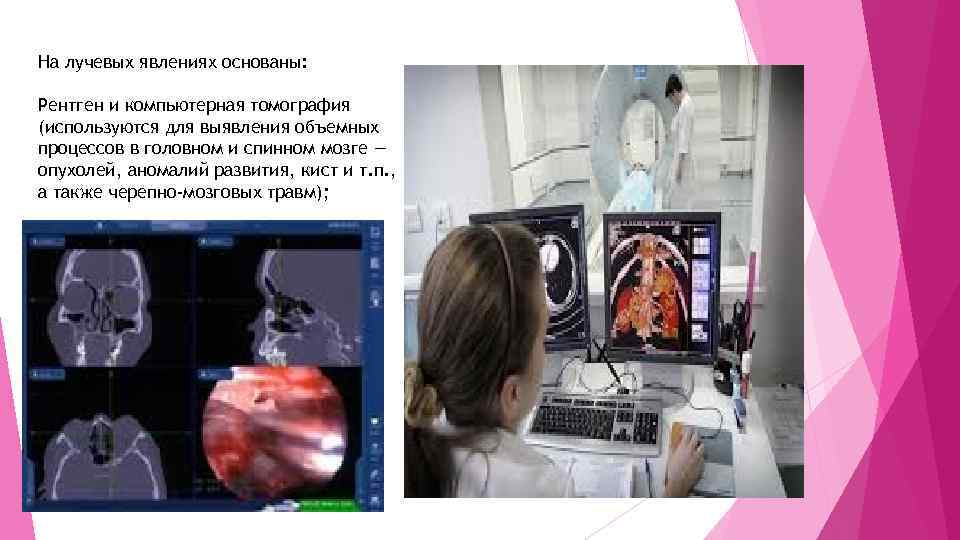 На лучевых явлениях основаны: Рентген и компьютерная томография (используются для выявления объемных процессов в