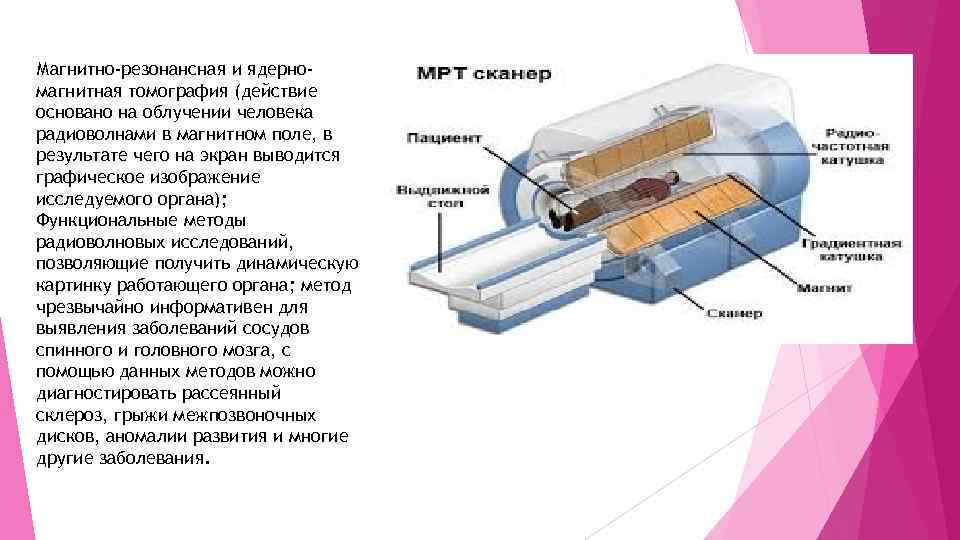 Магнитно-резонансная и ядерномагнитная томография (действие основано на облучении человека радиоволнами в магнитном поле, в