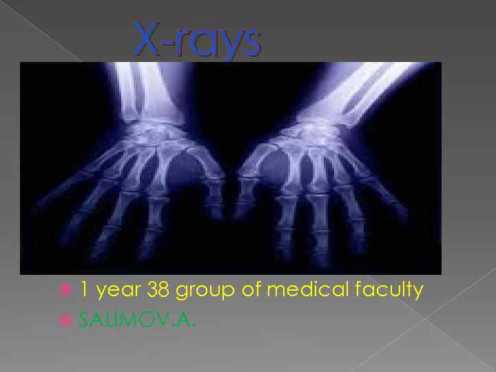 X-rays 1 year 38 group of medical faculty SALIMOV. A. 