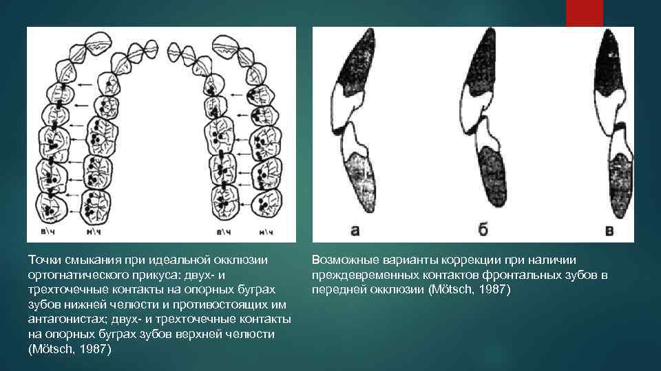 Точки смыкания при идеальной окклюзии ортогнатического прикуса: двух- и трехточечные контакты на опорных буграх