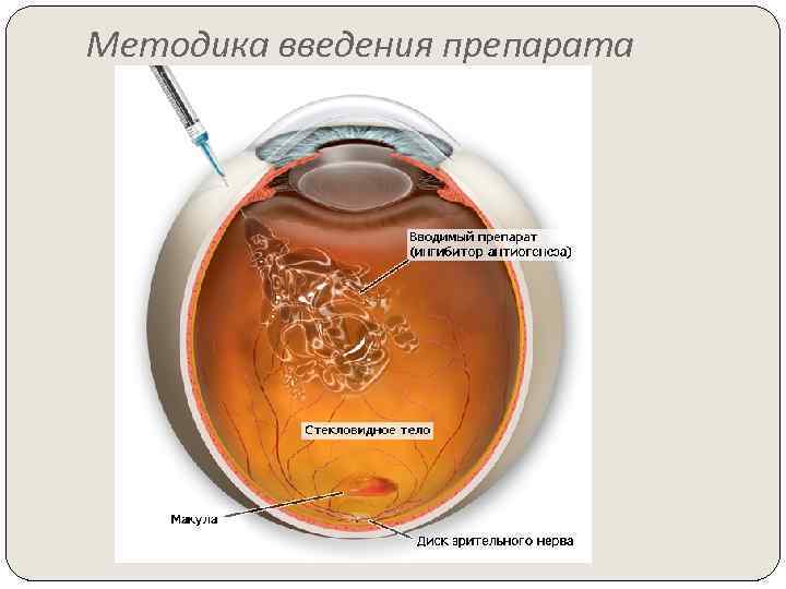 Методика введения препарата 