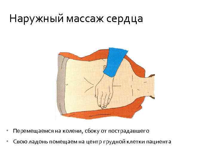 Наружный массаж сердца • Перемещаемся на колени, сбоку от пострадавшего • Свою ладонь помещаем