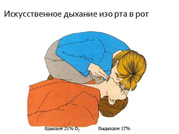 Искусственное дыхание изо рта в рот Вдыхаем 21% О 2 Выдыхаем 17% 