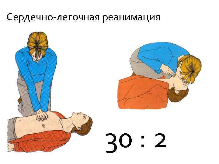 Сердечно-легочная реанимация 30 : 2 