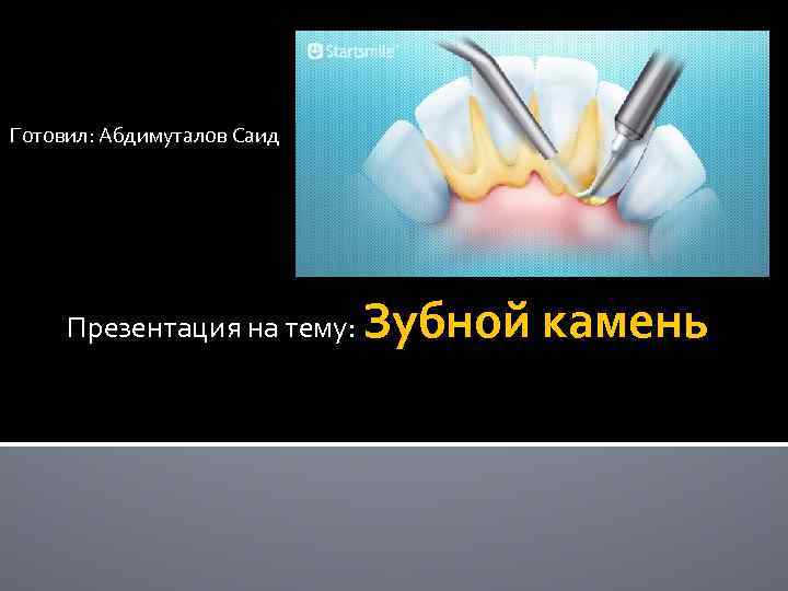 Готовил: Абдимуталов Саид Презентация на тему: Зубной камень 
