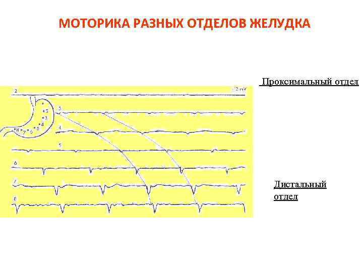 МОТОРИКА РАЗНЫХ ОТДЕЛОВ ЖЕЛУДКА Проксимальный отдел Дистальный отдел 