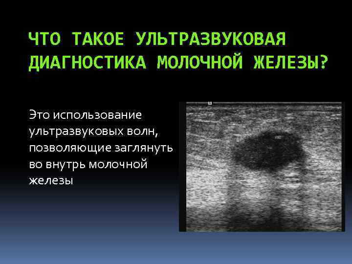 ЧТО ТАКОЕ УЛЬТРАЗВУКОВАЯ ДИАГНОСТИКА МОЛОЧНОЙ ЖЕЛЕЗЫ? Это использование ультразвуковых волн, позволяющие заглянуть во внутрь