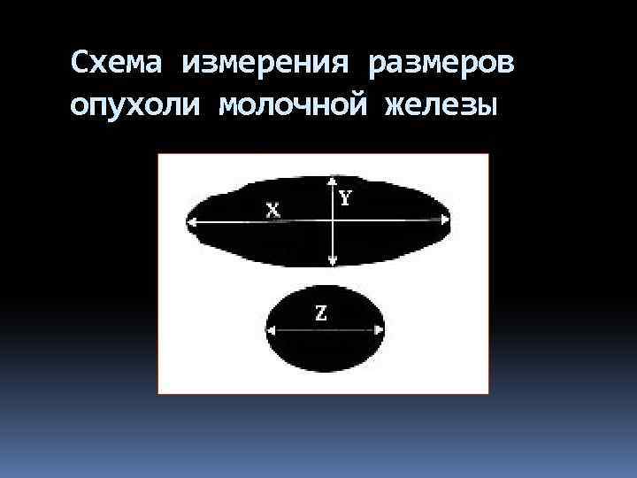 Схема измерения размеров опухоли молочной железы 