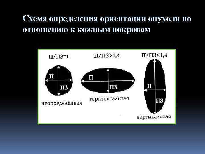 Схема определения ориентации опухоли по отношению к кожным покровам 