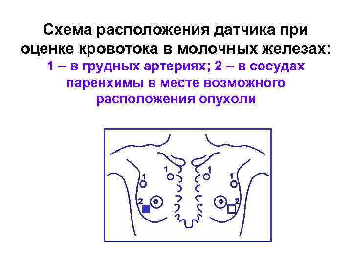 Кровоток опухоль молочной железы. Схема молочной железы. Схема аосмотр молочных желез датчиком. Схема молочных желез цветная. Схема молочных желез по циферблату.