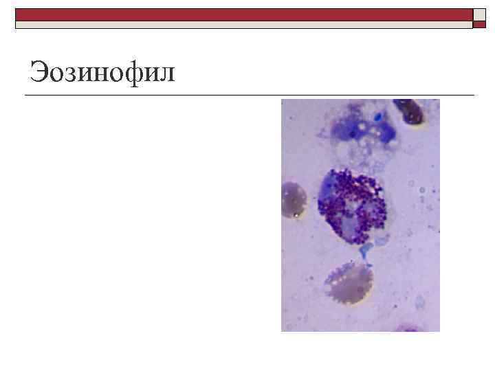 Выпотные жидкости презентация