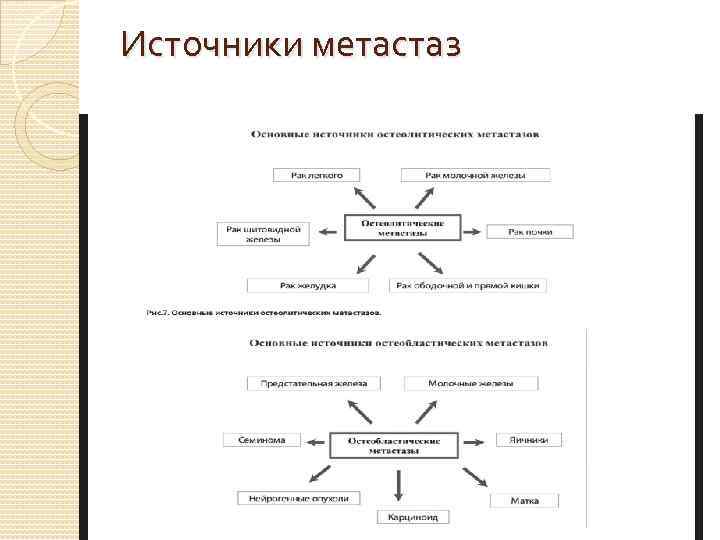 Источники метастаз 