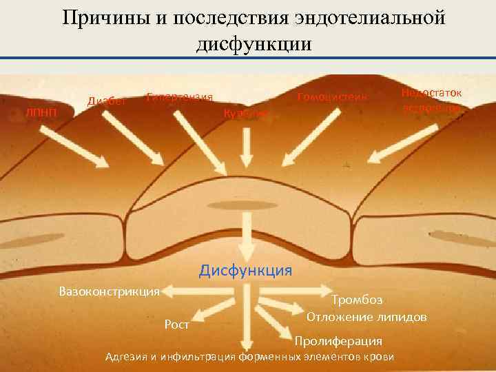 Причины и последствия эндотелиальной дисфункции ЛПНП Диабет Гипертензия Гомоцистеин Курение Недостаток эстрогенов Дисфункция Вазоконстрикция