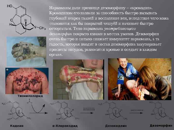 Наркоманы дали прозвище дезоморфину – «крокодил» . Крокодилом его назвали за способность быстро вызывать