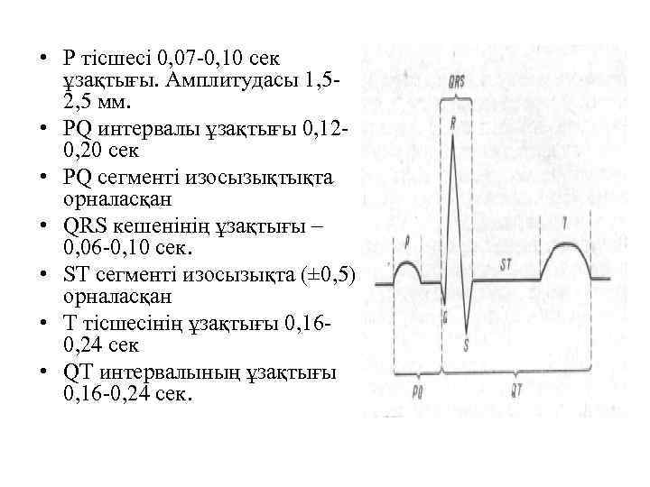  • P тісшесі 0, 07 -0, 10 сек ұзақтығы. Амплитудасы 1, 52, 5