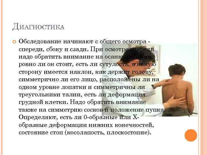 ДИАГНОСТИКА Обследование начинают с общего осмотра спереди, сбоку и сзади. При осмотре спереди надо
