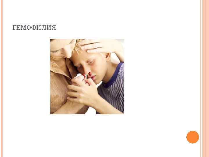 ГЕМОФИЛИЯ 