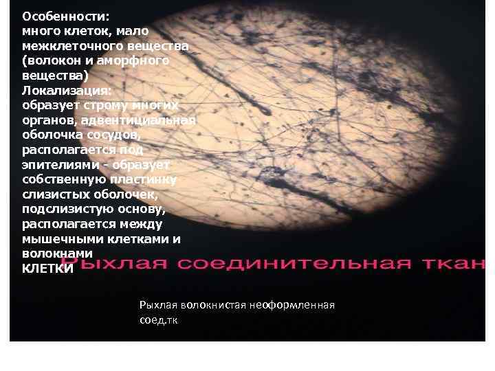 Особенности: много клеток, мало межклеточного вещества (волокон и аморфного вещества) Локализация: образует строму многих