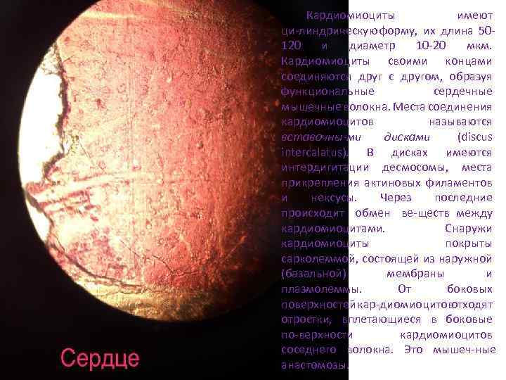 Кардиомиоциты имеют ци линдрическую форму, их длина 50 120 и диаметр 10 20 мкм.