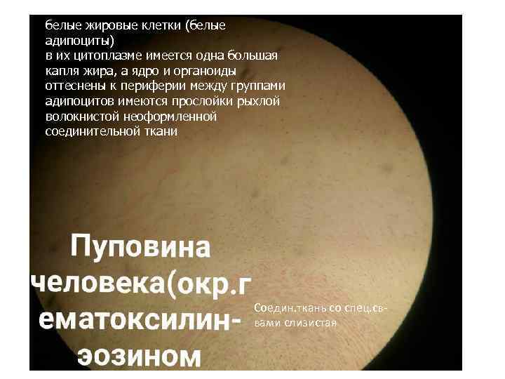 белые жировые клетки (белые адипоциты) в их цитоплазме имеется одна большая капля жира, а