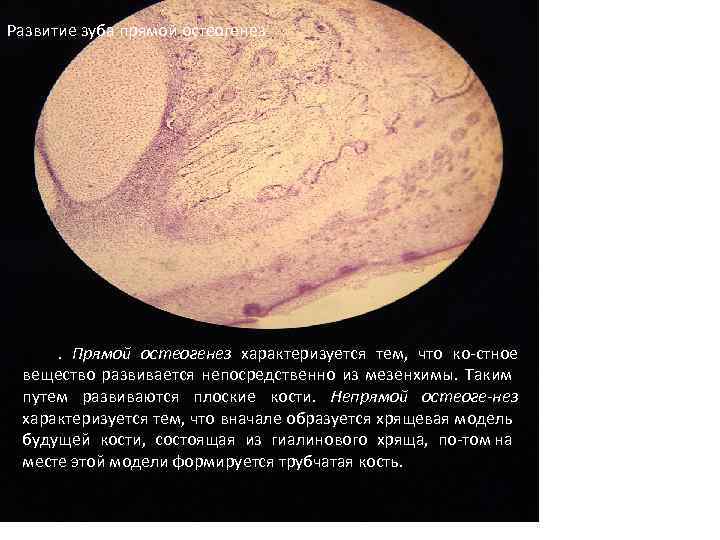 Развитие зуба прямой остеогенез . Прямой остеогенез характеризуется тем, что ко стное вещество развивается