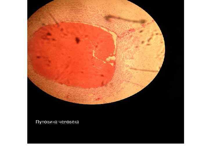 Пуповина человека 
