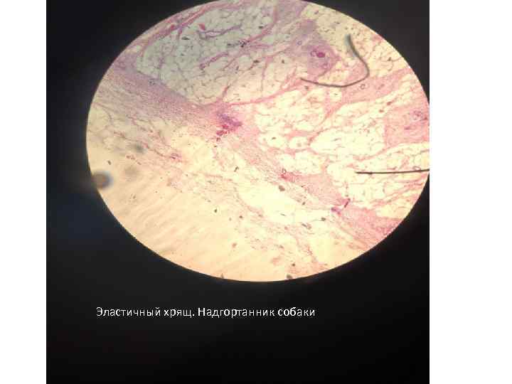 Эластичный хрящ. Надгортанник собаки 