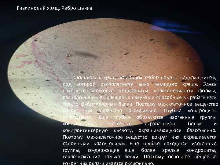 Гиалиновый хрящ. Ребро щенка Шалиновый хрящ на концах ребер покрыт надхрящницей, под которой располагается