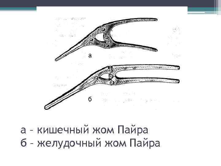 а – кишечный жом Пайра б – желудочный жом Пайра 