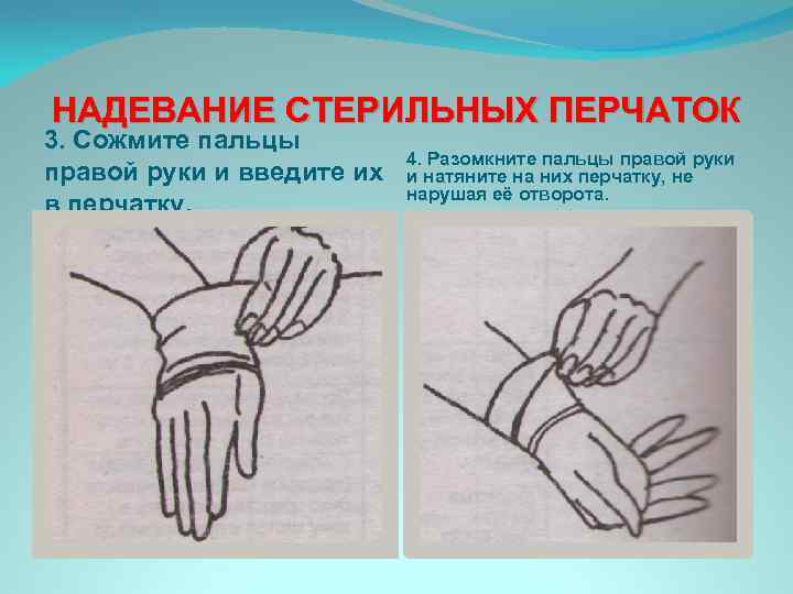 Надевать стерильные перчатки в случаях. Надевание стерильных перчаток. Схема надевания стерильных перчаток. Техника одевания стерильных перчаток. Схема одевания перчаток.