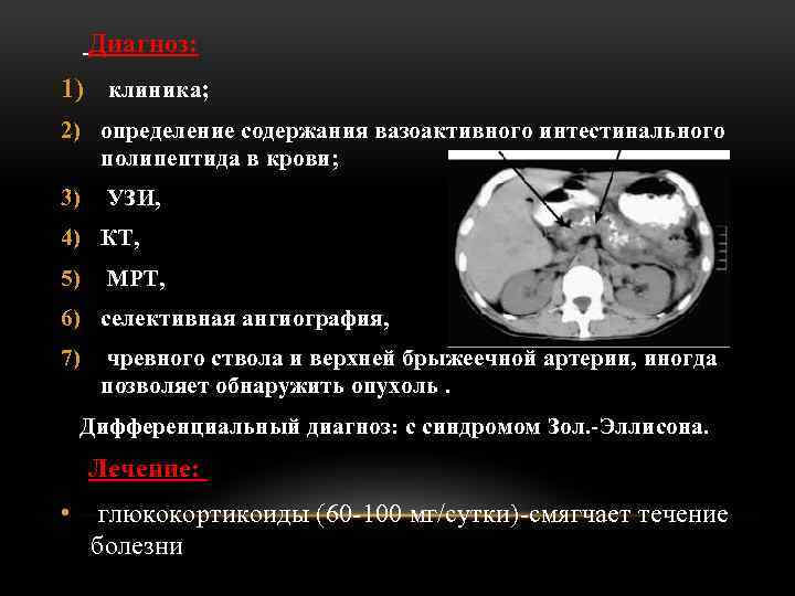 Диагноз: 1) клиника; 2) определение содержания вазоактивного интестинального полипептида в крови; 3) УЗИ, 4)