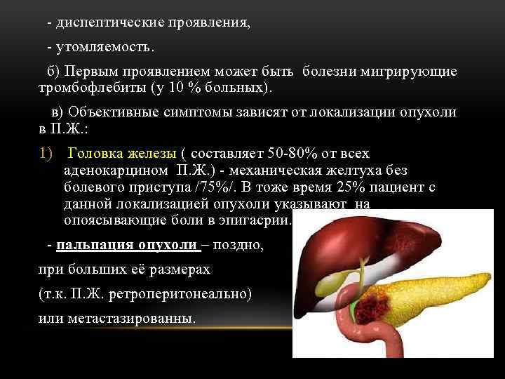 - диспептические проявления, - утомляемость. б) Первым проявлением может быть болезни мигрирующие тромбофлебиты (у