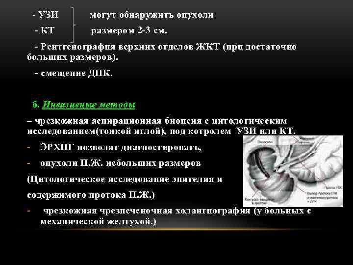 - УЗИ могут обнаружить опухоли - КТ размером 2 -3 см. - Рентгенография верхних