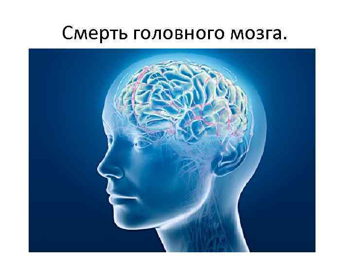 Смерть головного мозга. 