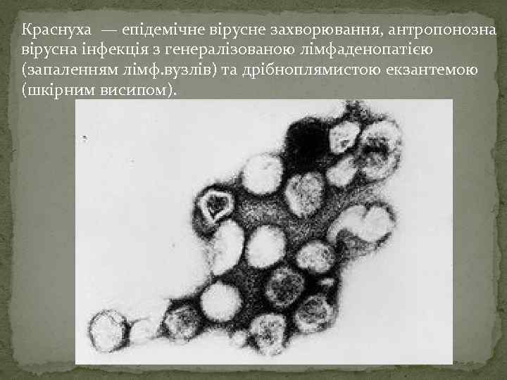 Краснуха — епідемічне вірусне захворювання, антропонозна вірусна інфекція з генералізованою лімфаденопатією (запаленням лімф. вузлів)