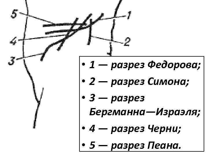  • 1 — разрез Федорова; • 2 — разрез Симона; • 3 —