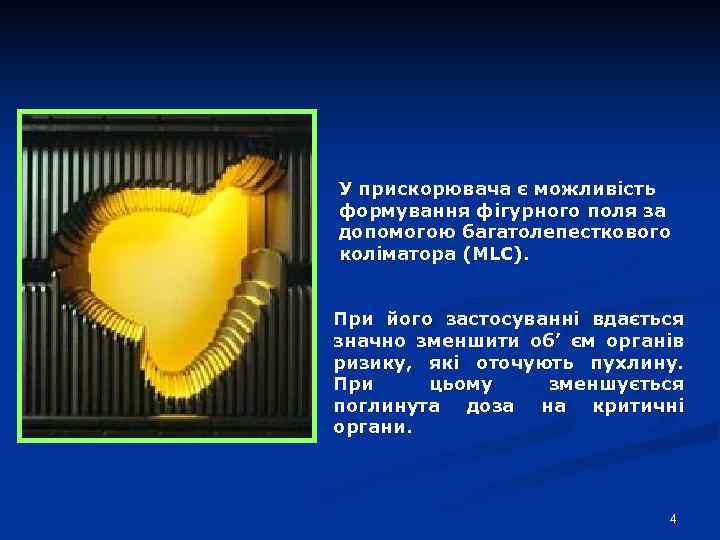 У прискорювача є можливість формування фігурного поля за допомогою багатолепесткового коліматора (MLC). При його