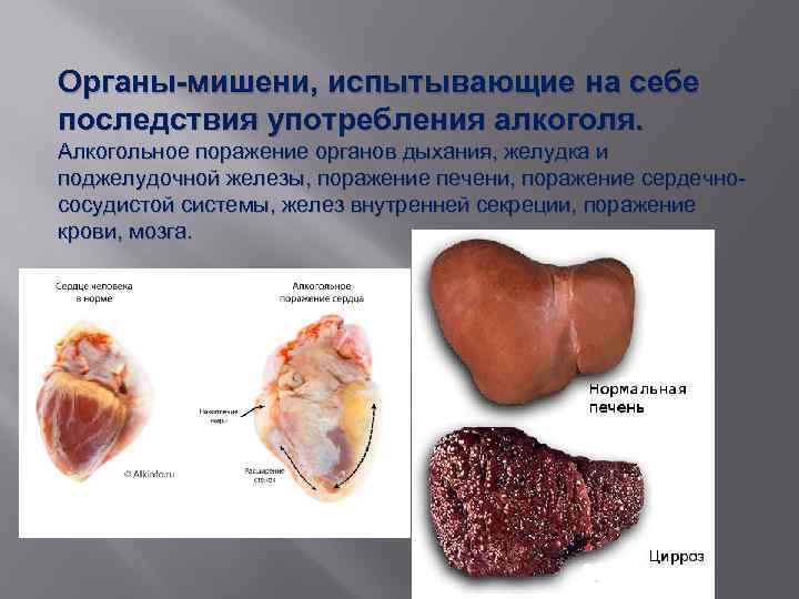 Последствия употребления алкоголя картинки