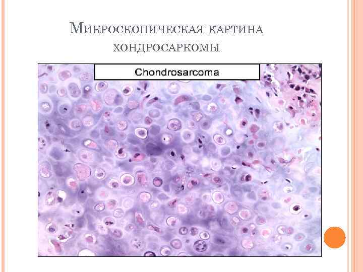 Микроскопическая картина