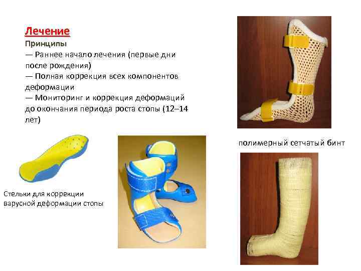 Лечение Принципы — Раннее начало лечения (первые дни после рождения) — Полная коррекция всех