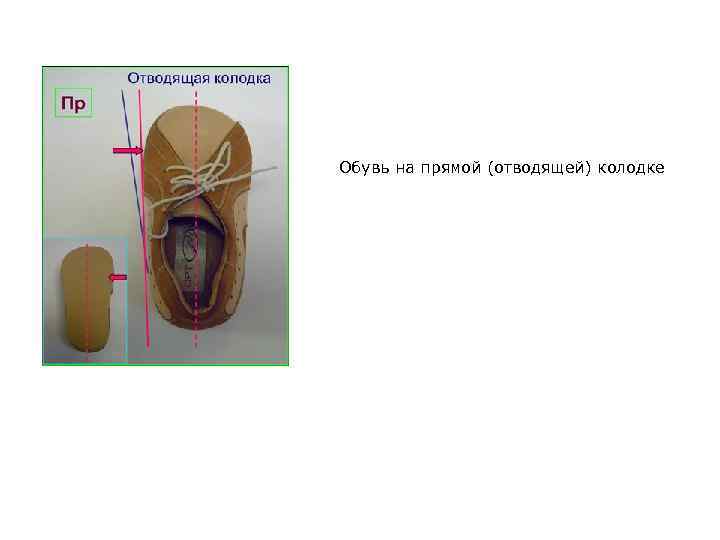  Обувь на прямой (отводящей) колодке 