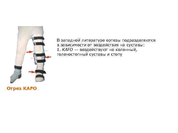 В западной литературе ортезы подразделяются в зависимости от воздействия на суставы: 1. KAFO —