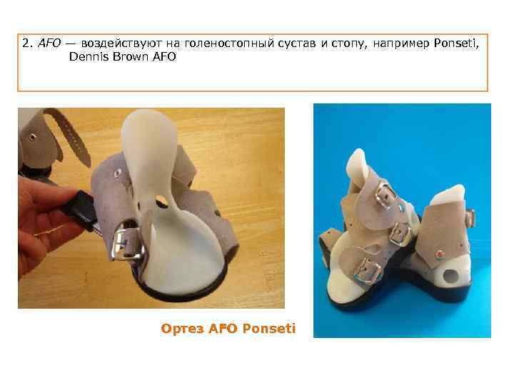  2. AFO — воздействуют на голеностопный сустав и стопу, например Ponseti, Dennis Brown
