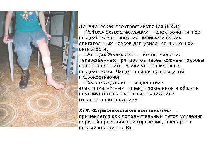  Динамическая электростимуляция (ИКД) — Нейроэлектростимуляция — электромагнитное воздействие в проекции периферических двигательных нервов