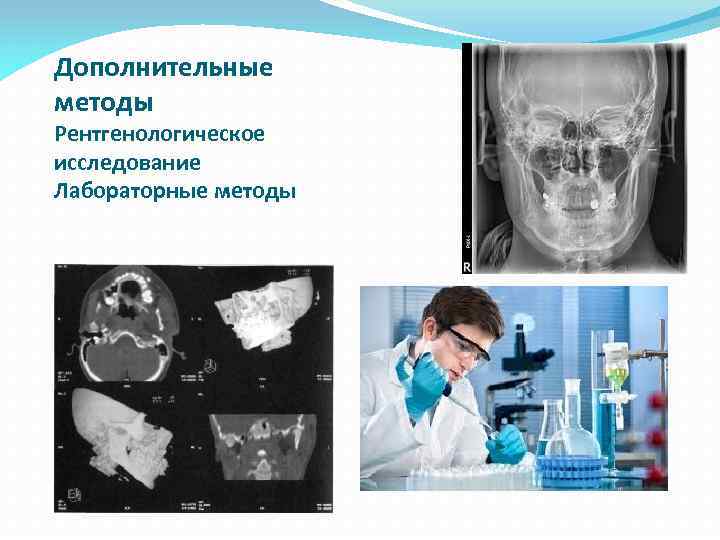 Дополнительные методы обследования внчс презентация